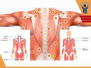 تریگر پوینت یا نقاط ماشه ای / فیزیوتراپی در شرق تهران