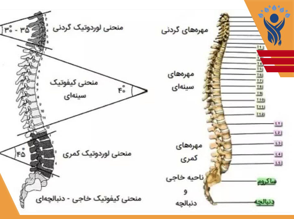انحناهای ستون فقرات /فیزیوتراپی در تهرانپارس