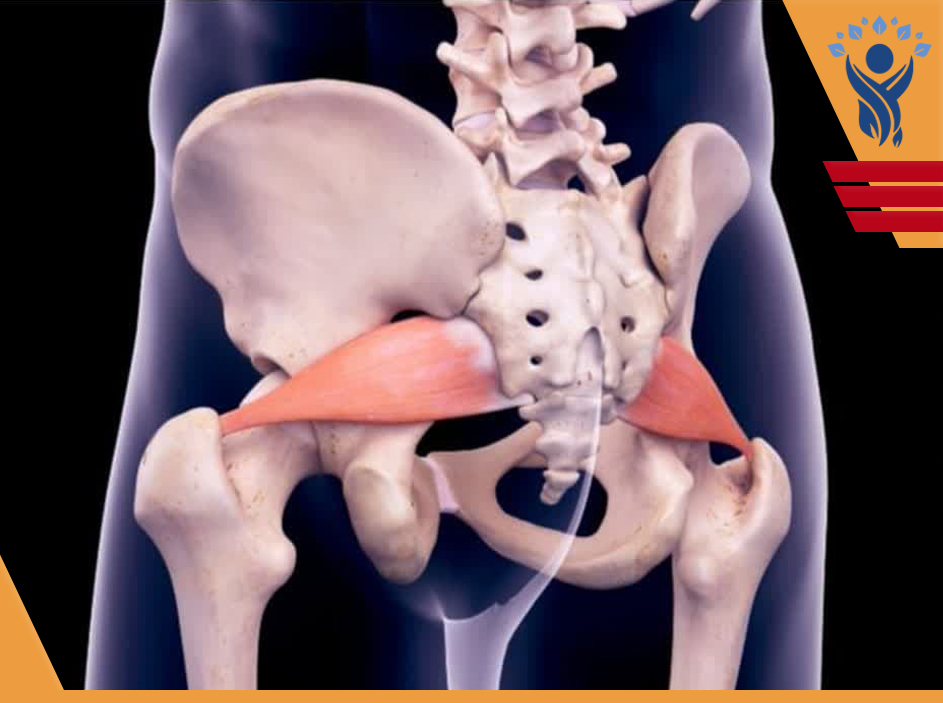 سندرم پیریفورمیس ( Piriformis Syndrome )/فیزیوتراپی در تهرانپارس