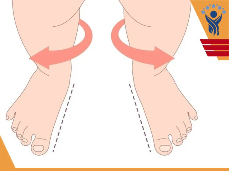چرخش پا به سمت خارج / فیزیوتراپی در فلکه سوم تهرانپارس