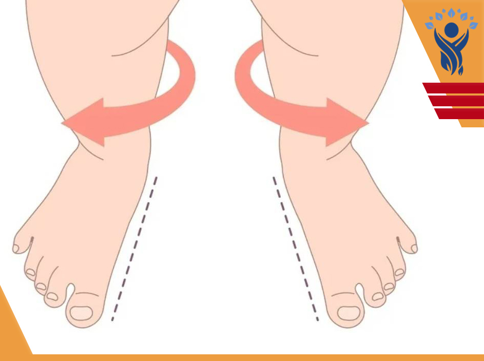 چرخش پا به سمت خارج / فیزیوتراپی در فلکه سوم تهرانپارس