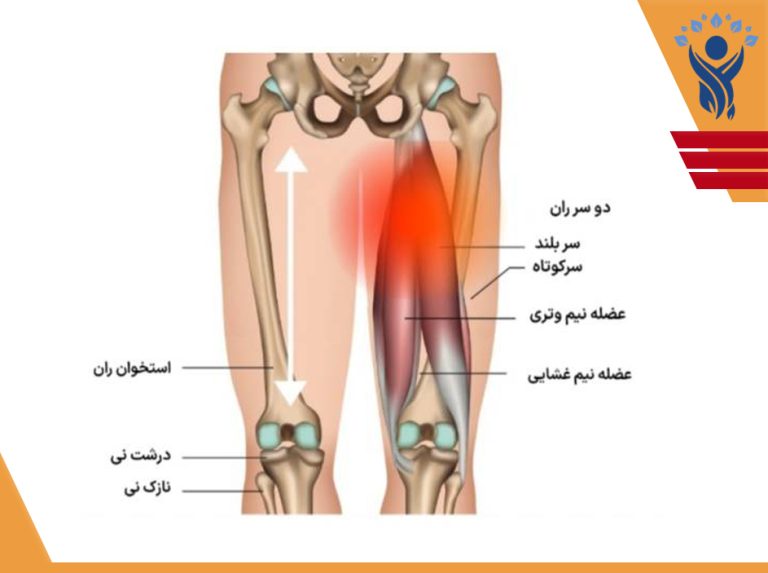 عضلات همسترینگ (Hamstrings) ،مجموعه‌ای از سه عضله قدرتمند در بخش پشتی ران هستند که یکی از مهم‌ترین گروه‌های عضلانی برای حرکت دادن