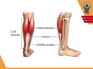 عضلات Calf /فیزیوتراپی در فلکه سوم تهرانپارس